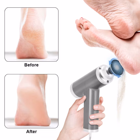 New Design Callus Removers